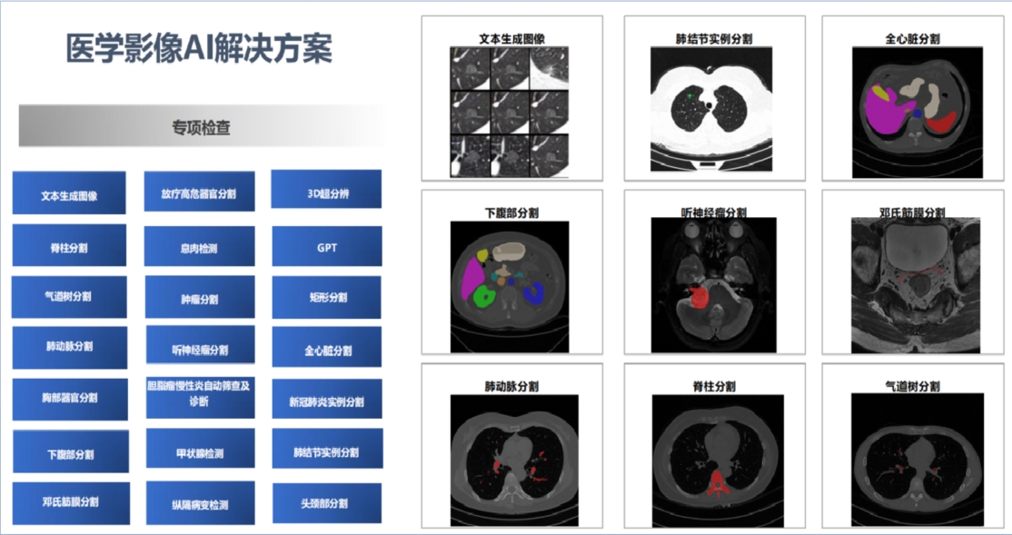 超声图像智能测量及评级系统